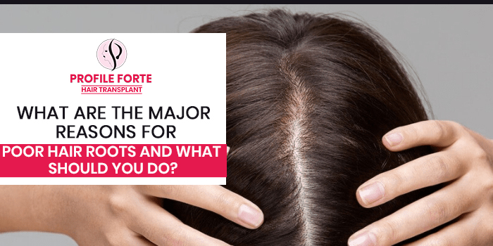 What are the major reasons for poor hair roots and what should you do?