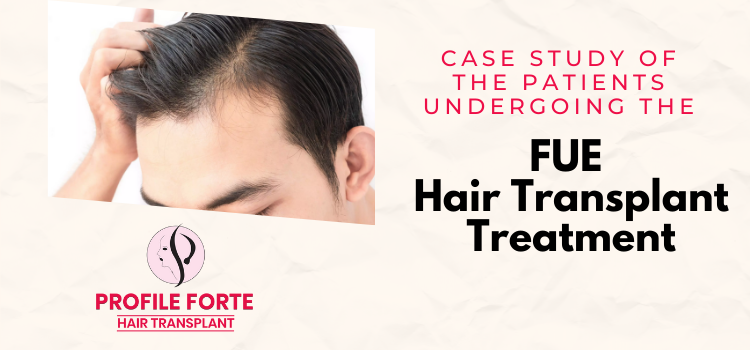 Case study of the patients undergoing the FUE hair transplant treatment