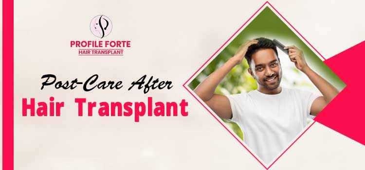 What are the topmost tips to take care of your hair after a hair transplant?