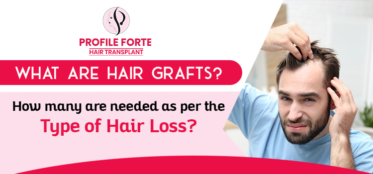 What are hair grafts? How many are needed as per the type of hair loss?