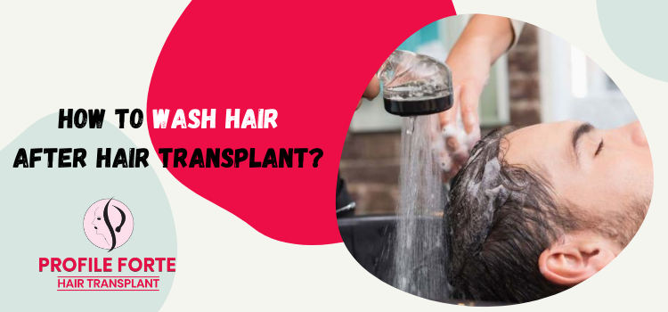 Which tips will prove immensely helpful in washing the hair after transplant?