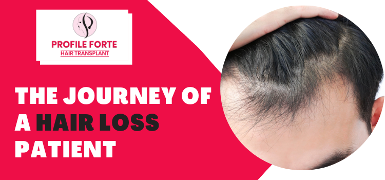 4 Milestones –  Every Hair Loss Patient Has To Undergo During Hair Transplantation