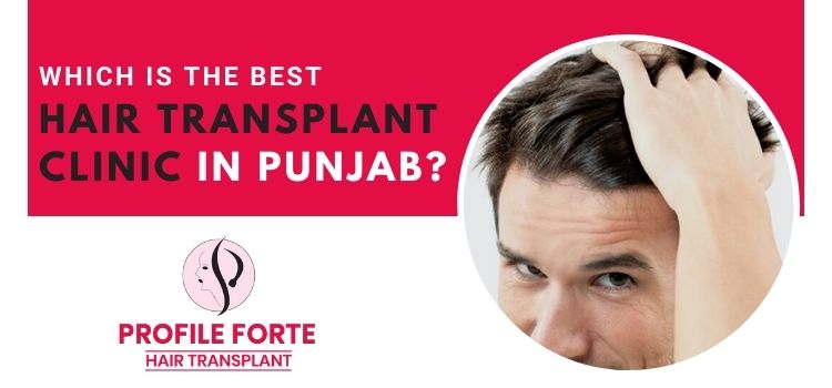 How to find the best hair transplant clinic? Which one is best in Punjab?
