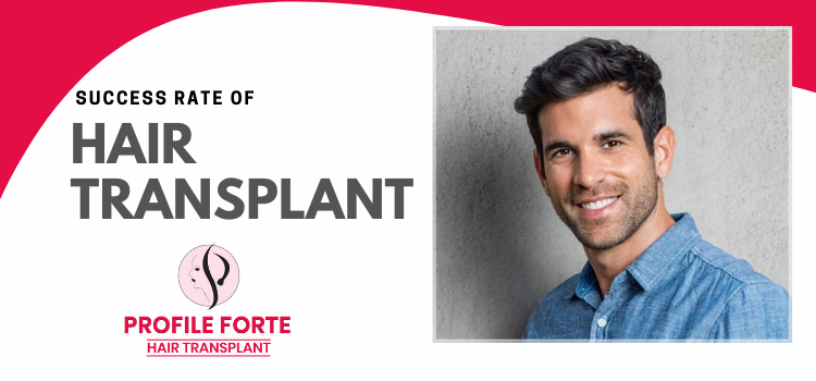 Profile Forte: Everything about the success rate of the hair transplant procedure