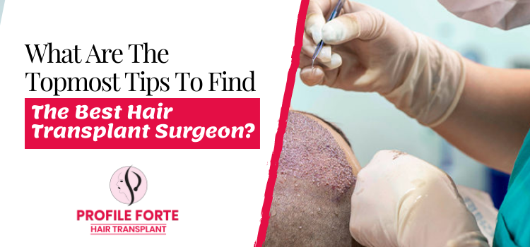 What are the topmost tips to find the best hair transplant surgeon?