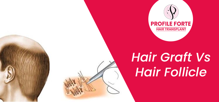 How are hair grafts and hair follicles different from each other?