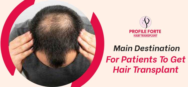 4 reasons Profile Forte is one of the first options for hair transplant in India