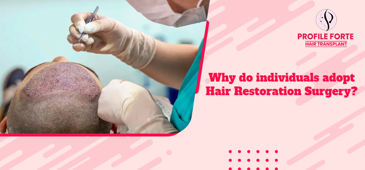 What are the main reasons to compel people to go for hair transplants?