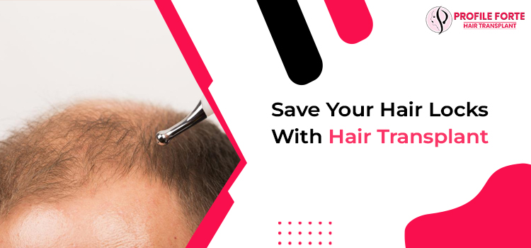 Hair Transplant Treatment – All In One Solution For Hair Loss