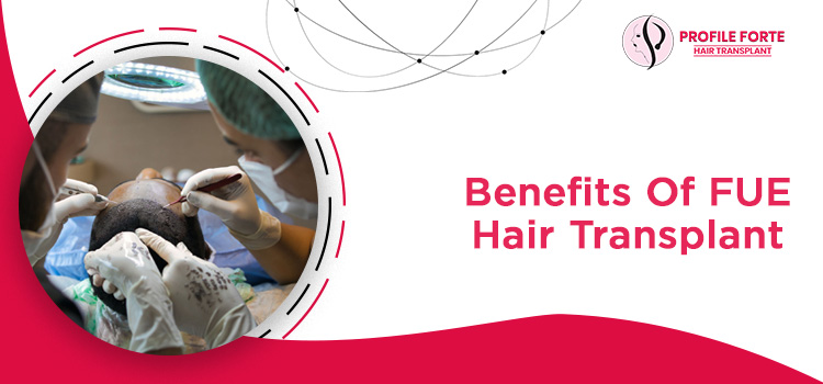 What are the 5 benefits of undergoing FUE hair transplant treatment?