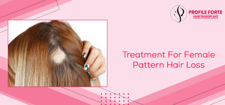 How to effectively manage noticeable female pattern hair loss?