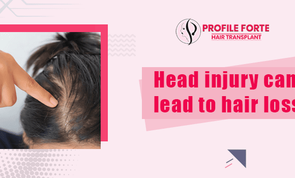Is it true that ‘Head trauma is one of the major reasons behind hair loss?’
