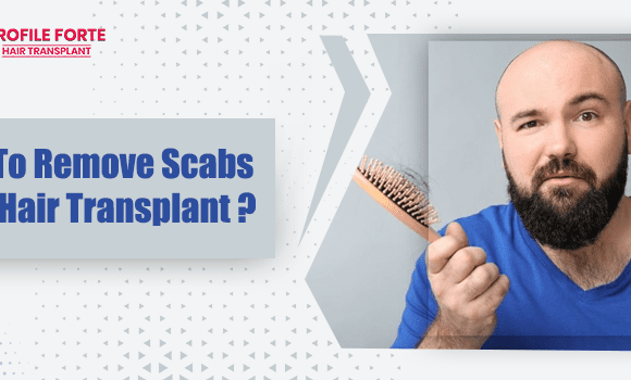 Few Techniques To Deal With Scabs Post Hair Transplant Surgery