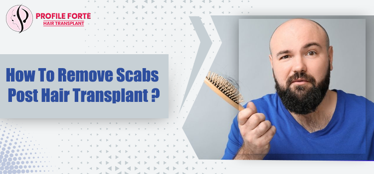 Few Techniques To Deal With Scabs Post Hair Transplant Surgery
