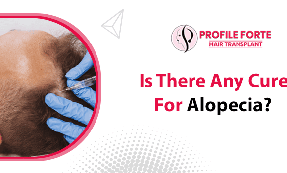 Can Alopecia be cured? Which is the ideal treatment for hair growth?
