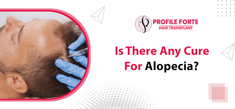 Can Alopecia be cured? Which is the ideal treatment for hair growth?