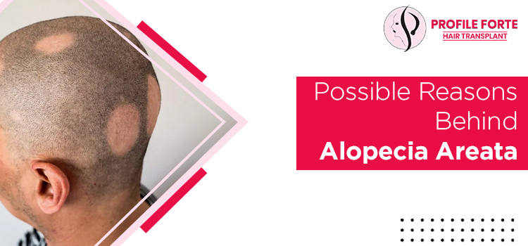 Hair Loss: What are the possible reasons behind alopecia areata?