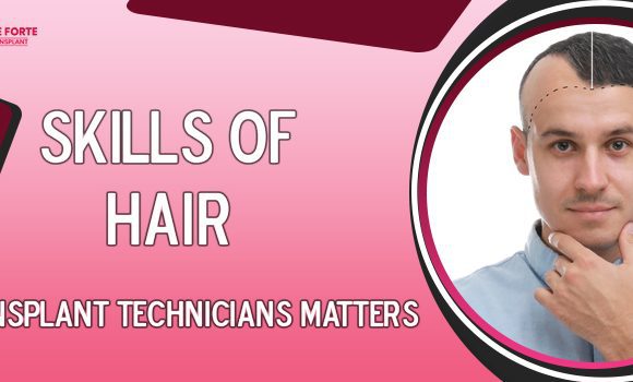 What’s the role of hair transplant technicians in treatment success?