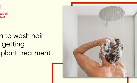 Guidance about washing hair after getting hair transplant treatment