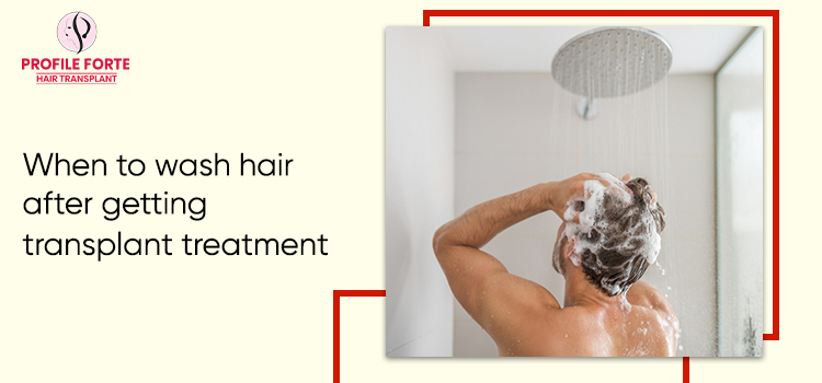 Guidance about washing hair after getting hair transplant treatment