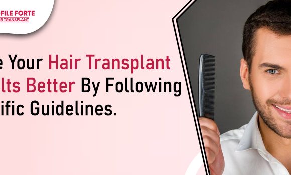Guide: Things To Do & Not Do Before Your Hair Transplant