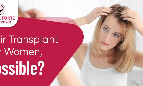Is Hair Transplant Just For Men? What About Women’s Hair Loss Issues